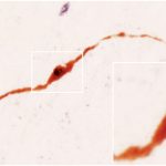 Both immersion-fixed and perfusion-fixed hypothalami are used routinely in immunohistochemical studies. The figure illustrates the results of double-label immunohistochemical experiments which revealed estrogen receptor beta immunoreactivity (black) in human GnRH neurons (brown).